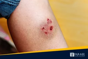 california dog bite laws